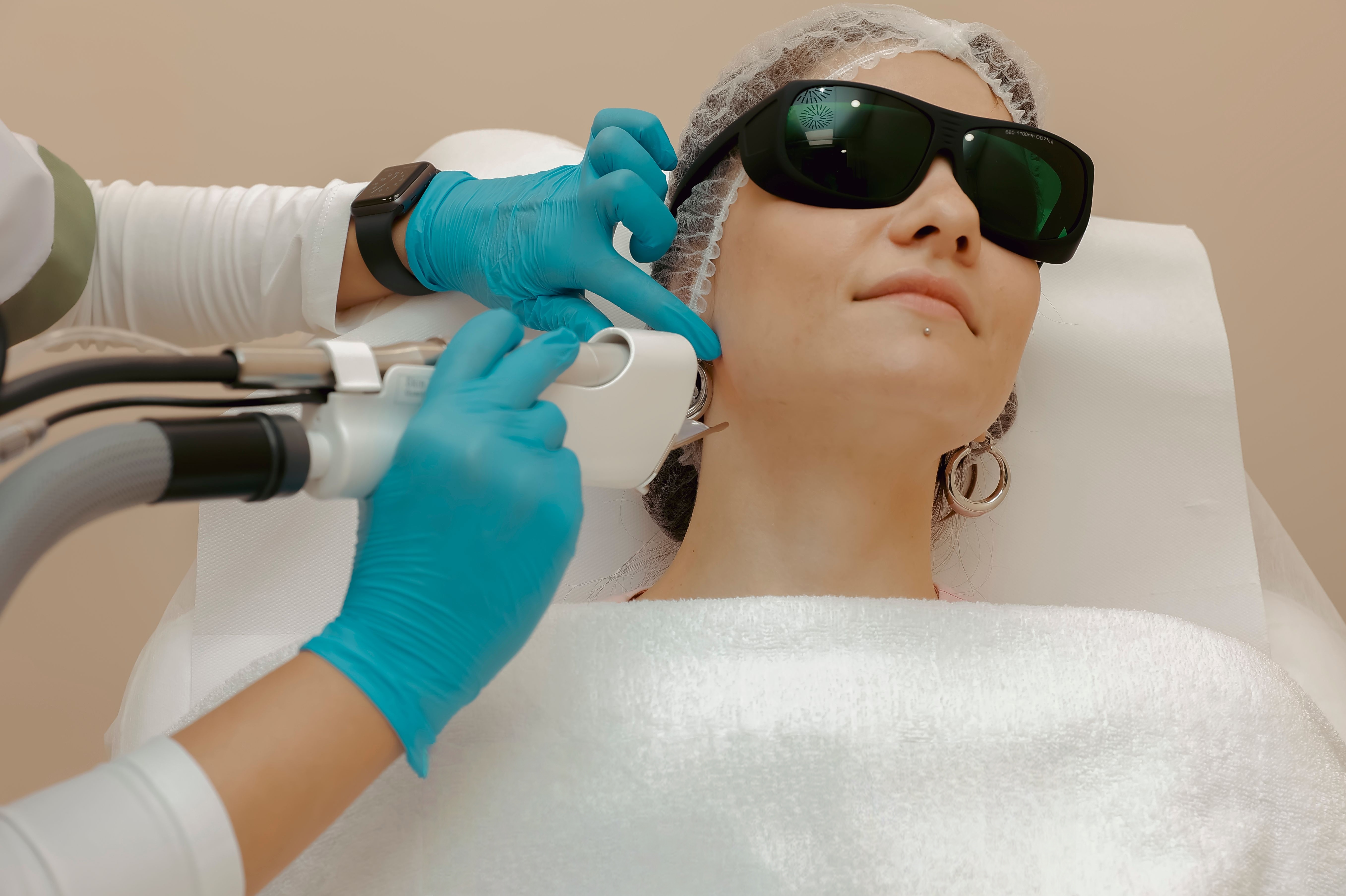 Lumecca IPL treatment session